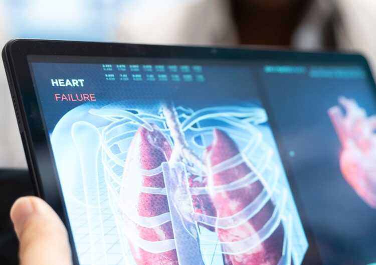 Contaminación del aire y salud respiratoria en mujeres mexicanas: evidencia del estudio ESMAESTRAS